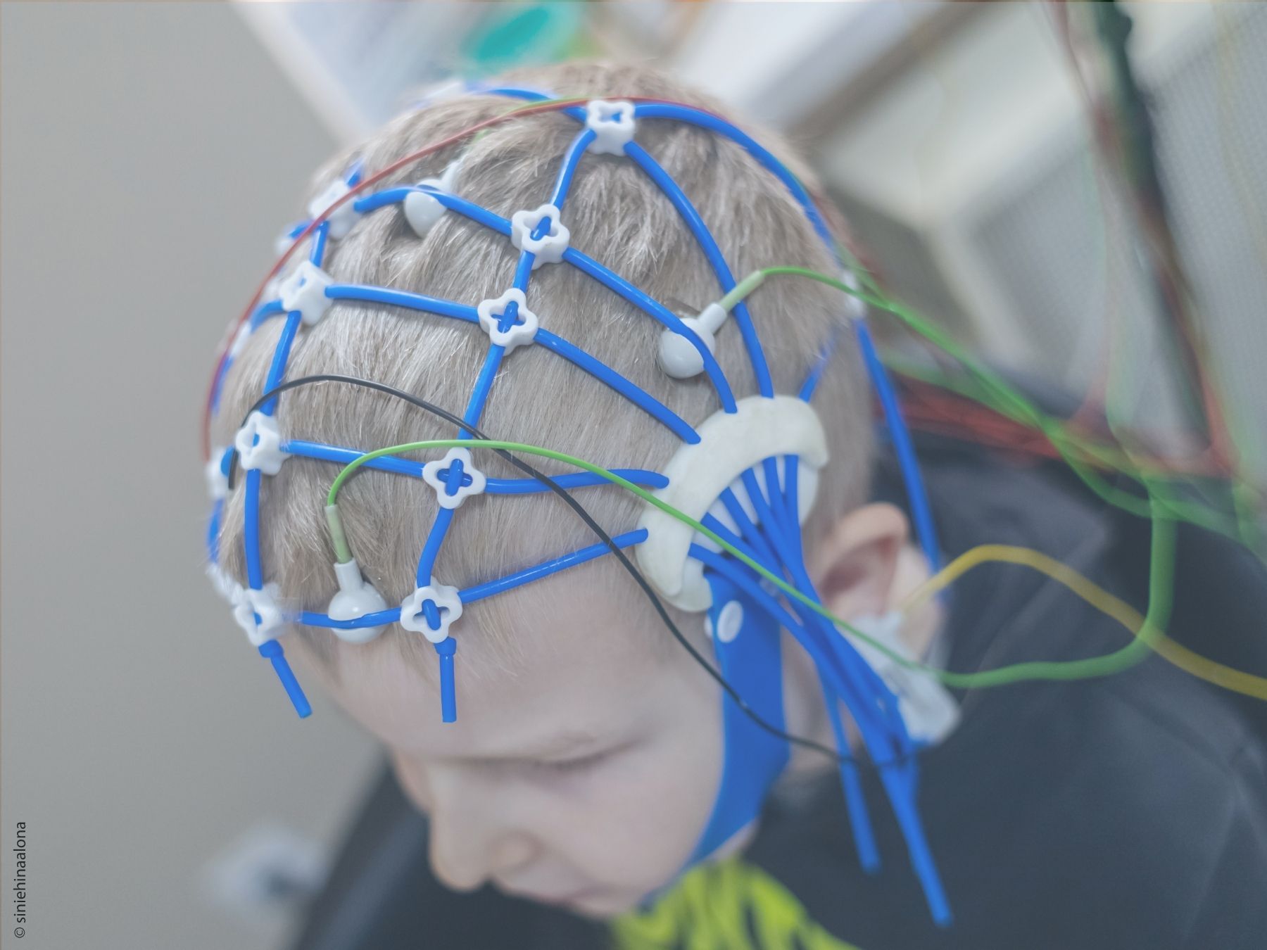 Wie sieht ein Anfall aus beim DS?